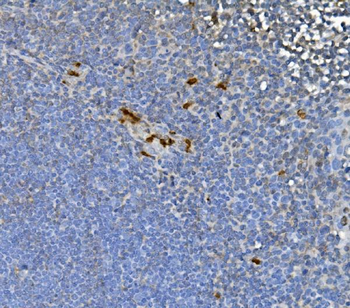 JUNB Rabbit Polyclonal Antibody