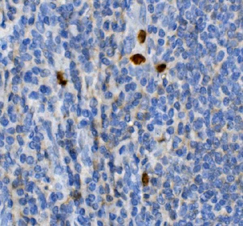 JUNB Rabbit Polyclonal Antibody
