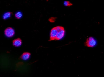MEK2/MAP2K2 Rabbit Polyclonal Antibody