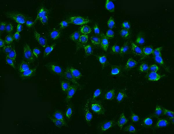 MEK2/MAP2K2 Rabbit Polyclonal Antibody
