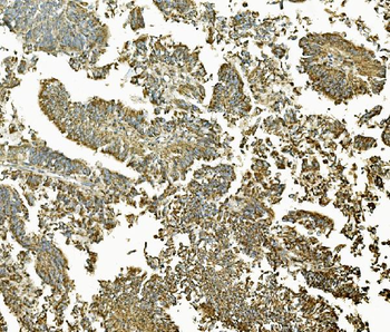 MEK2/MAP2K2 Rabbit Polyclonal Antibody