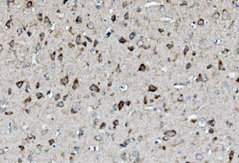 MEK2/MAP2K2 Rabbit Polyclonal Antibody