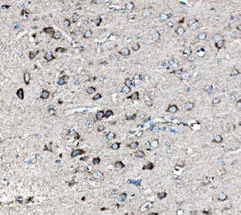 MEK2/MAP2K2 Rabbit Polyclonal Antibody
