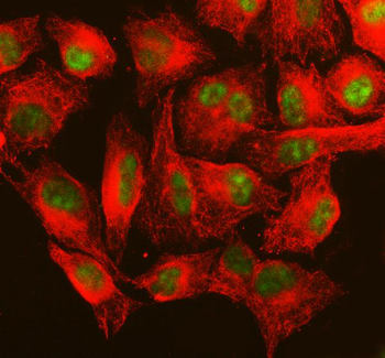 MSH6 Rabbit Polyclonal Antibody