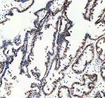 MSH6 Rabbit Polyclonal Antibody