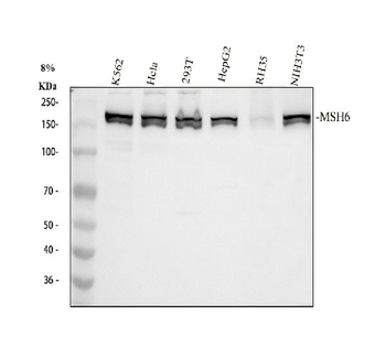 MSH6 Rabbit Polyclonal Antibody