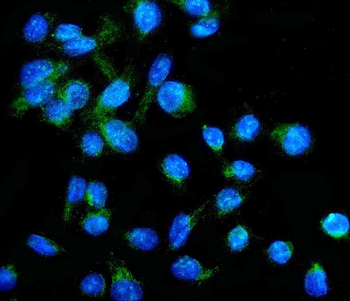 NFE2L2 Rabbit Polyclonal Antibody