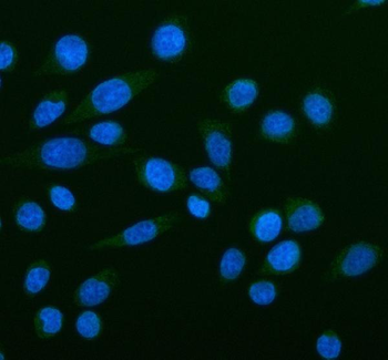 NOX5 Rabbit Polyclonal Antibody