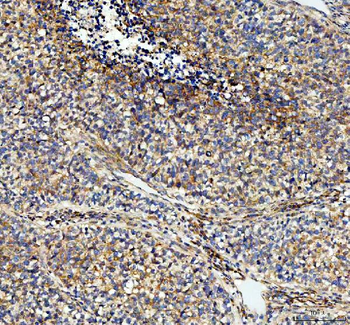 NOX5 Rabbit Polyclonal Antibody