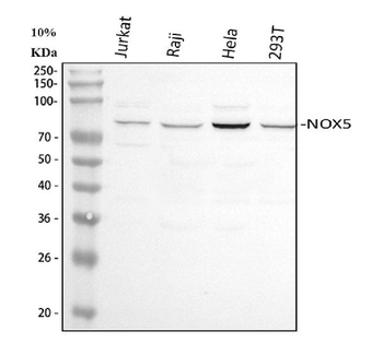 NOX5 Rabbit Polyclonal Antibody
