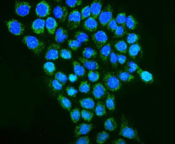 REA/PHB2 Rabbit Polyclonal Antibody