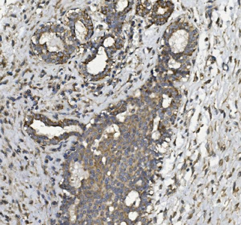 REA/PHB2 Rabbit Polyclonal Antibody
