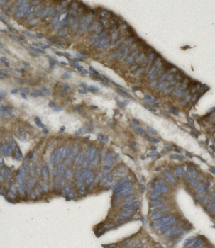 REA/PHB2 Rabbit Polyclonal Antibody