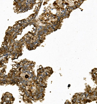 REN/Renin Rabbit Polyclonal Antibody