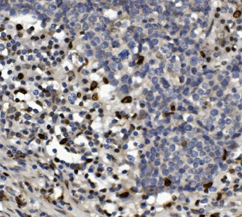 SAMHD1 Rabbit Polyclonal Antibody