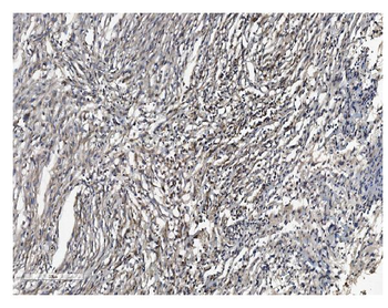 SHANK3 Rabbit Polyclonal Antibody