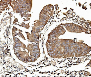 TAB2 Rabbit Polyclonal Antibody