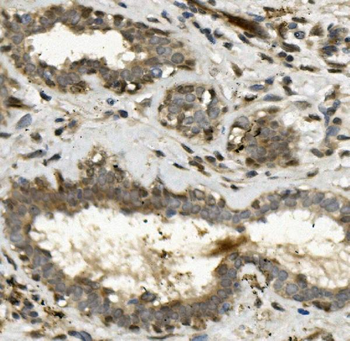 ETF/TEAD2 Rabbit Polyclonal Antibody