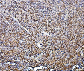 ETF/TEAD2 Rabbit Polyclonal Antibody