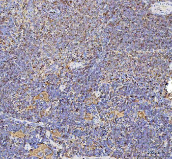 Talin 1/TLN1 Rabbit Polyclonal Antibody