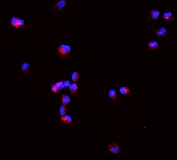 TNF alpha Rabbit Polyclonal Antibody