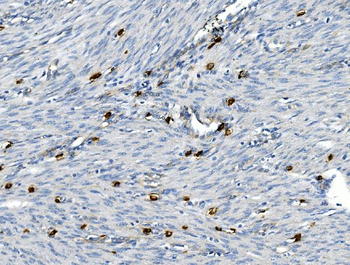 CD30/TNFRSF8 Rabbit Polyclonal Antibody
