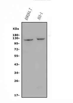 CD30/TNFRSF8 Rabbit Polyclonal Antibody