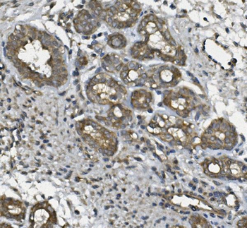 ULBP1 Rabbit Polyclonal Antibody