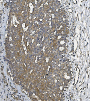 ULBP1 Rabbit Polyclonal Antibody