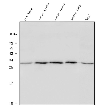 ULBP1 Rabbit Polyclonal Antibody