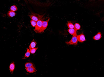 UNG Rabbit Polyclonal Antibody