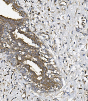 UNG Rabbit Polyclonal Antibody