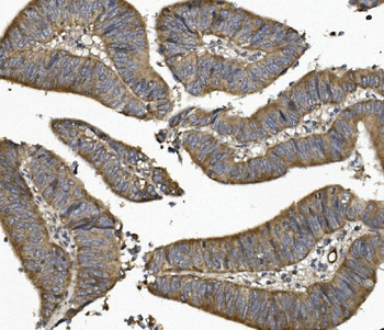 UNG Rabbit Polyclonal Antibody