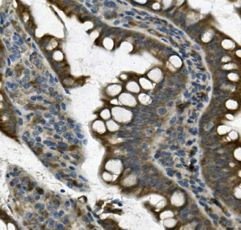 UNG Rabbit Polyclonal Antibody