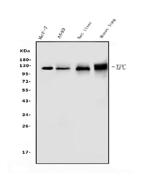 XPC Rabbit Polyclonal Antibody