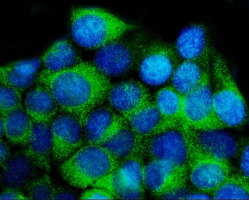 YWHAE Rabbit Polyclonal Antibody