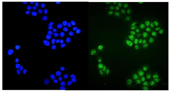 Plzf/ZBTB16 Rabbit Polyclonal Antibody