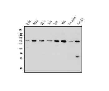 Plzf/ZBTB16 Rabbit Polyclonal Antibody