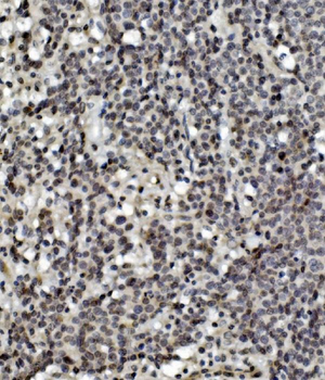 MCPIP1/ZC3H12A Rabbit Polyclonal Antibody