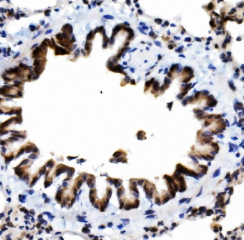 MCPIP1/ZC3H12A Rabbit Polyclonal Antibody