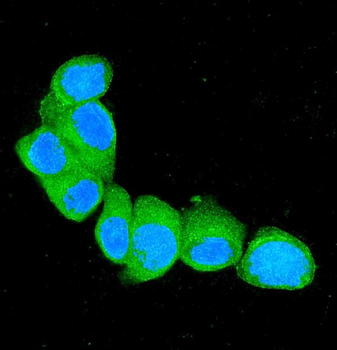 S100A4 Rabbit Polyclonal Antibody