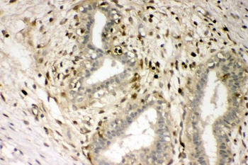 S100A4 Rabbit Polyclonal Antibody