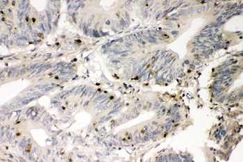 S100A4 Rabbit Polyclonal Antibody