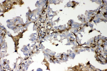 S100A4 Rabbit Polyclonal Antibody