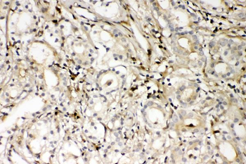 S100A4 Rabbit Polyclonal Antibody