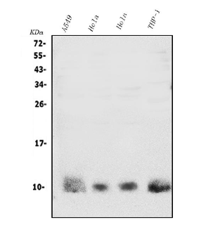 S100A4 Rabbit Polyclonal Antibody