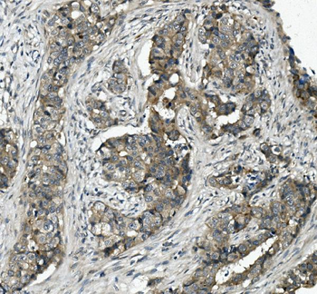 MRP5/ABCC5 Rabbit Polyclonal Antibody