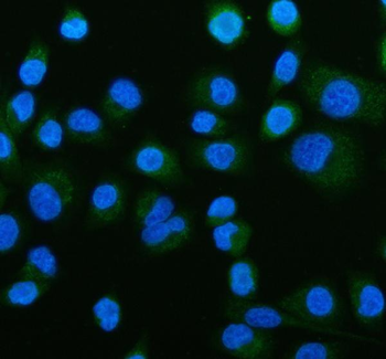 ACADS/SCAD Rabbit Polyclonal Antibody