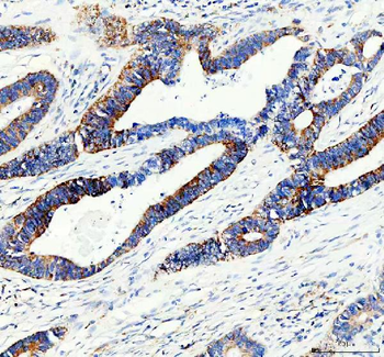 ACADS/SCAD Rabbit Polyclonal Antibody