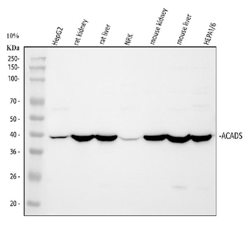 ACADS/SCAD Rabbit Polyclonal Antibody